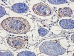 Immunohistochemical staining of rat skin tissue using anti-IL11 (dilution of primary antibody - 1:200)