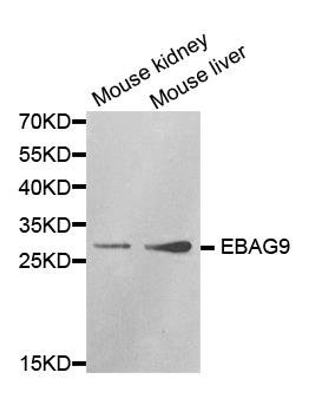 Western blot analysis of extracts of various cell lines using EBAG9 antibody