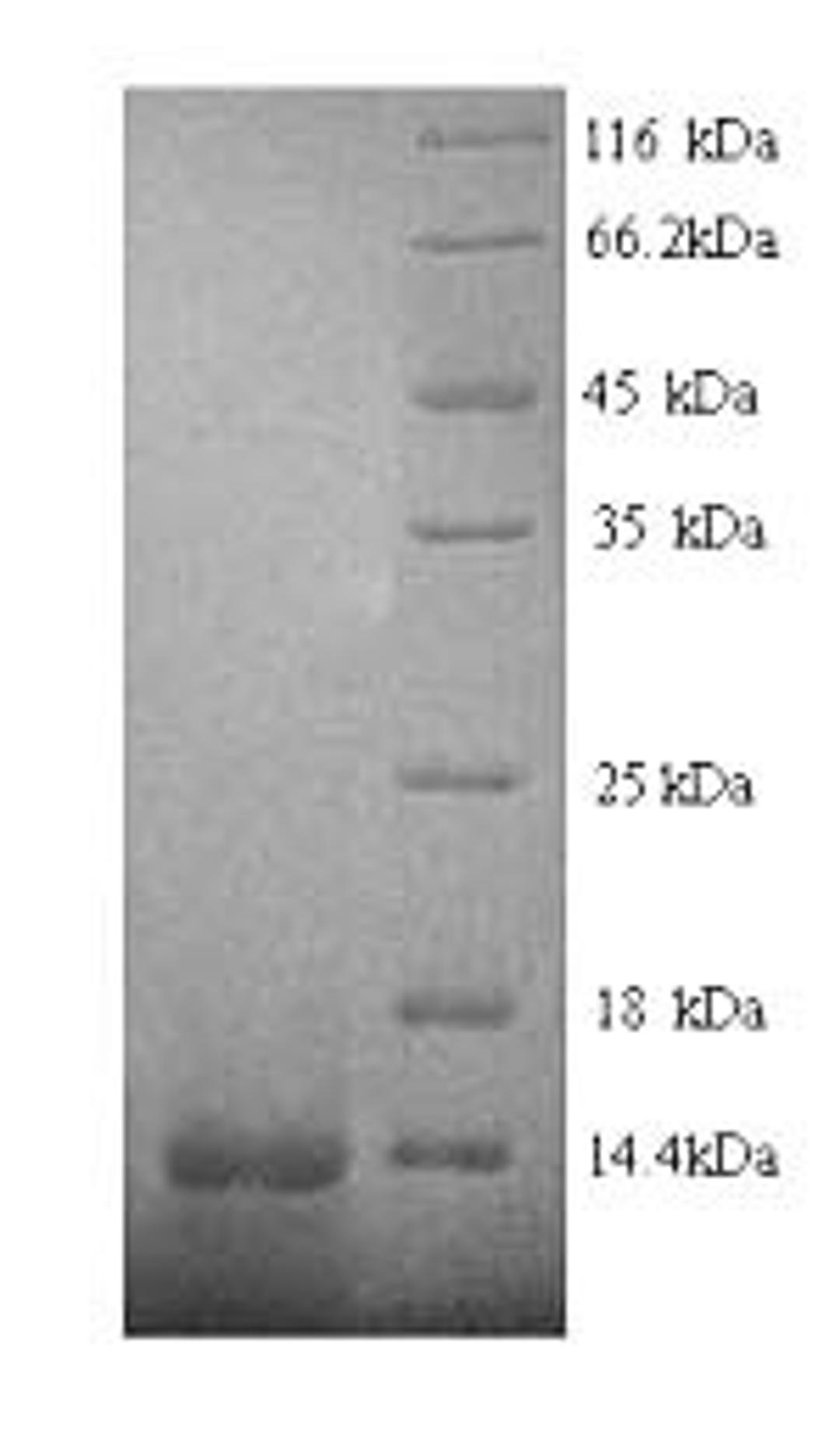 (Tris-Glycine gel) Discontinuous SDS-PAGE (reduced) with 5% enrichment gel and 15% separation gel.