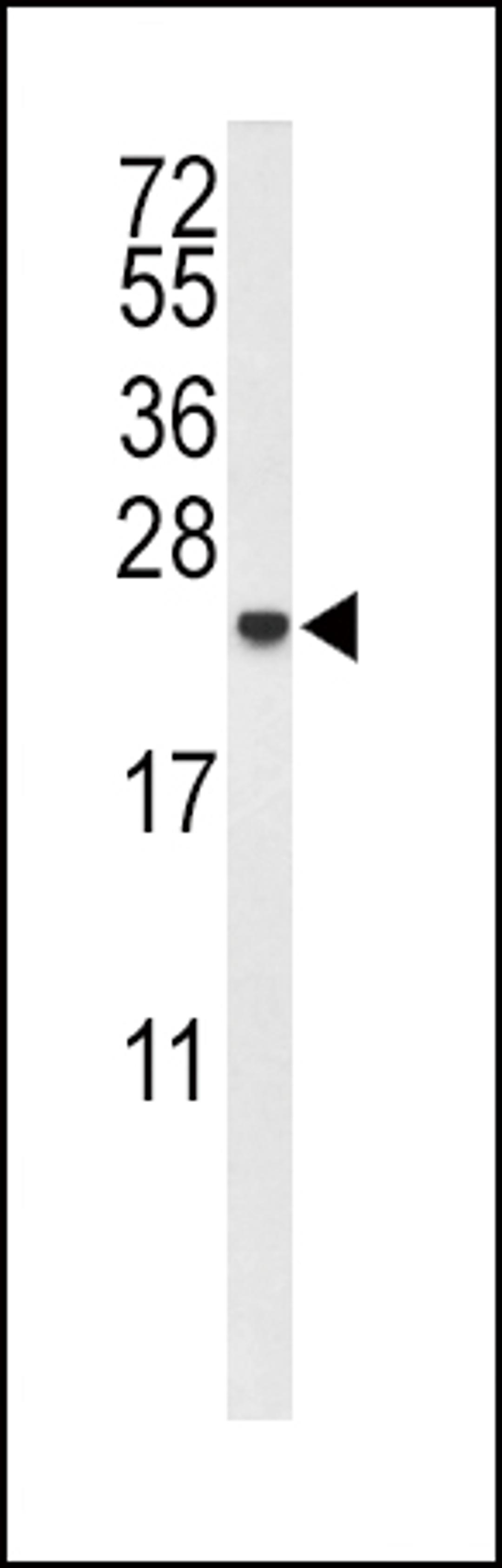 Western blot analysis of IL10 Antibody in MDA-MB435 cell line lysates (35ug/lane)