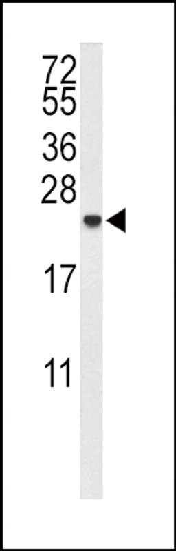 Western blot analysis of IL10 Antibody in MDA-MB435 cell line lysates (35ug/lane)