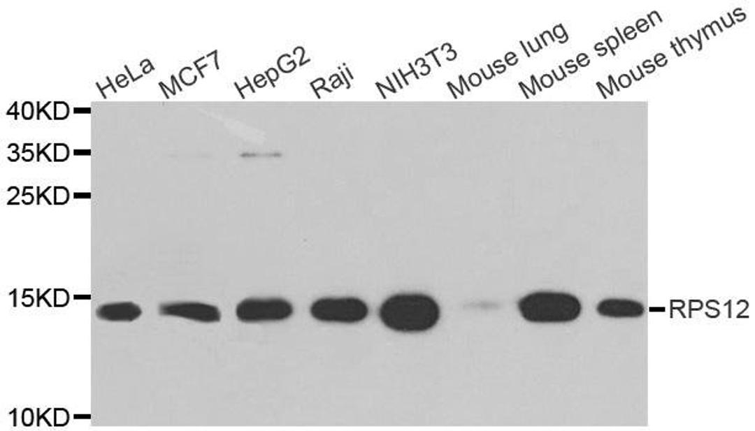 Western blot analysis of extracts of various cell lines using RPS12 antibody