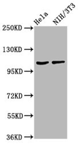 Western Blot. Positive WB detected in: Hela whole cell lysate, NIH/3T3 whole cell lysate. All lanes: MKL2 antibody at 4.2ug/ml. Secondary. Goat polyclonal to rabbit IgG at 1/50000 dilution. Predicted band size: 119, 43, 52, 115, 120 kDa. Observed band size: 119 kDa.
