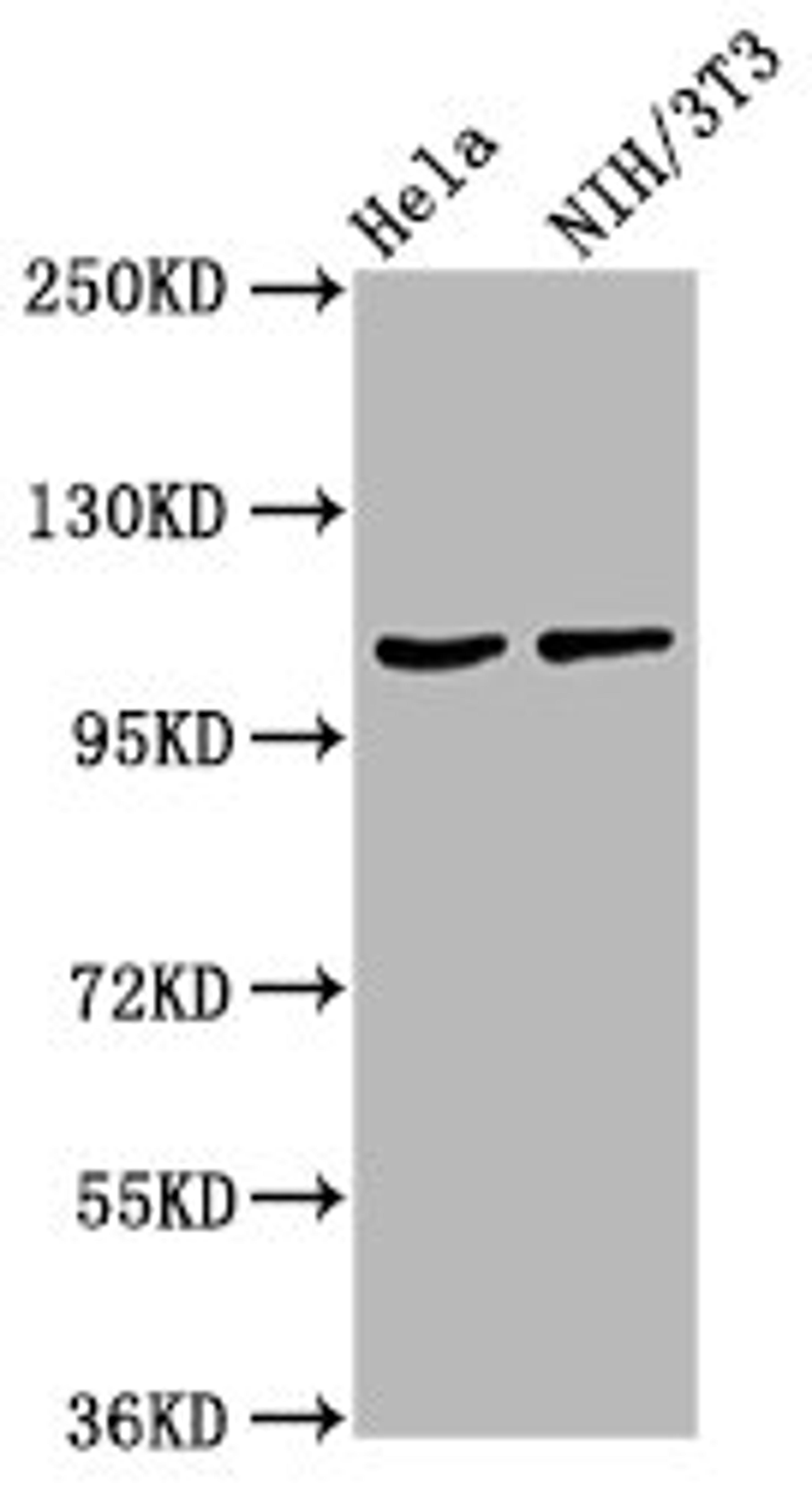 Western Blot. Positive WB detected in: Hela whole cell lysate, NIH/3T3 whole cell lysate. All lanes: MKL2 antibody at 4.2ug/ml. Secondary. Goat polyclonal to rabbit IgG at 1/50000 dilution. Predicted band size: 119, 43, 52, 115, 120 kDa. Observed band size: 119 kDa.