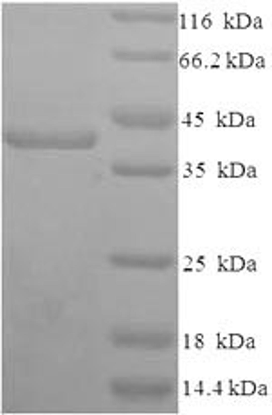 (Tris-Glycine gel) Discontinuous SDS-PAGE (reduced) with 5% enrichment gel and 15% separation gel.