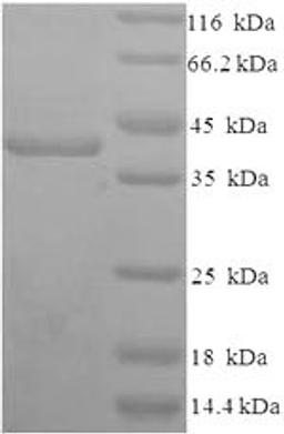 (Tris-Glycine gel) Discontinuous SDS-PAGE (reduced) with 5% enrichment gel and 15% separation gel.