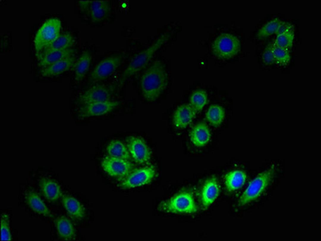 Immunofluorescent analysis of HepG2 cells using CSB-PA010565LA01HU at dilution of 1:100 and Alexa Fluor 488-congugated AffiniPure Goat Anti-Rabbit IgG(H+L)