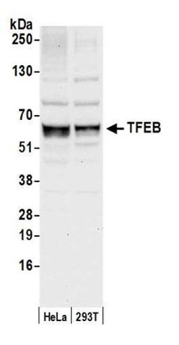 Detection of human TFEB by western blot.