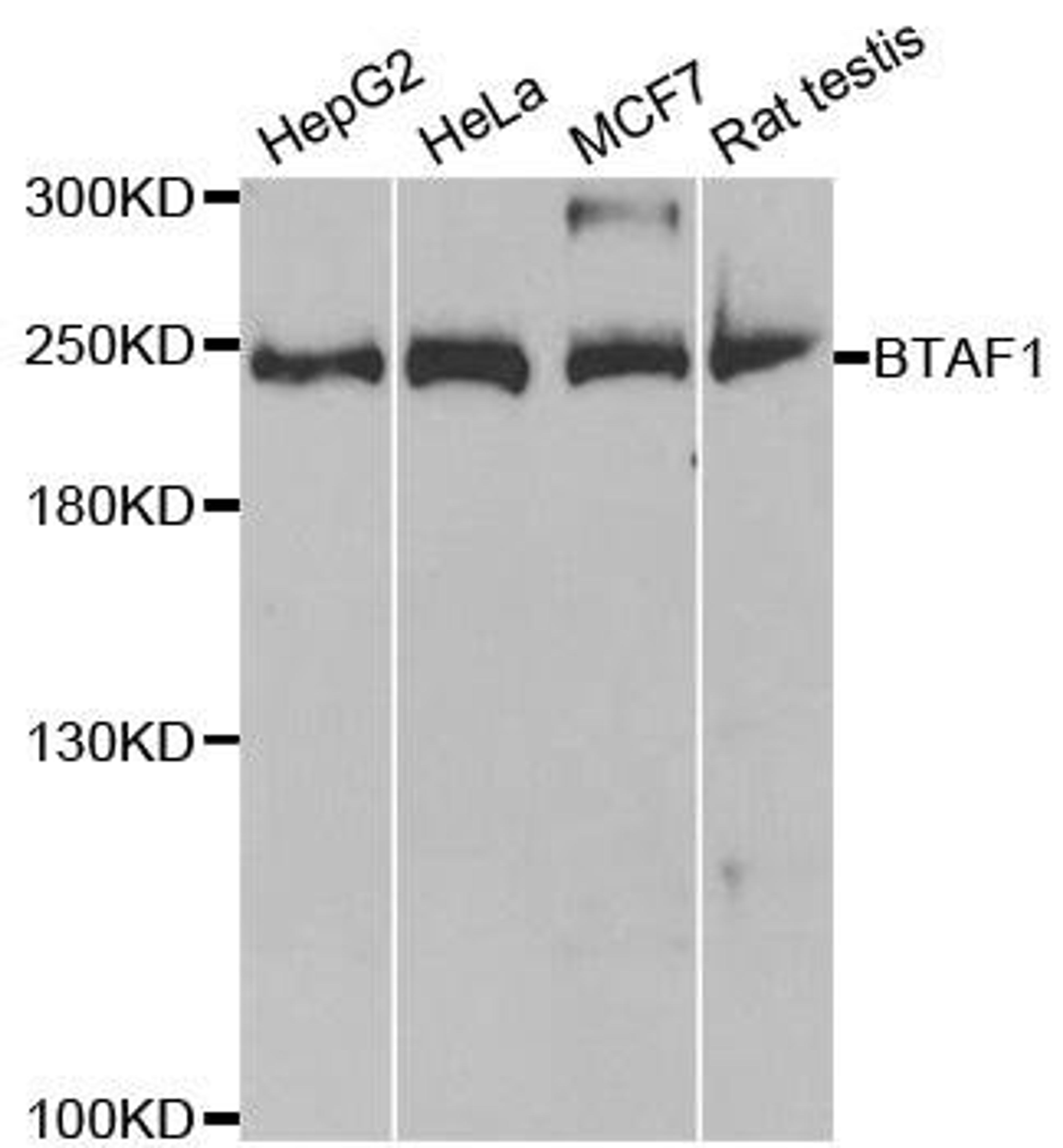 Western blot analysis of extracts of various cell lines using BTAF1 antibody