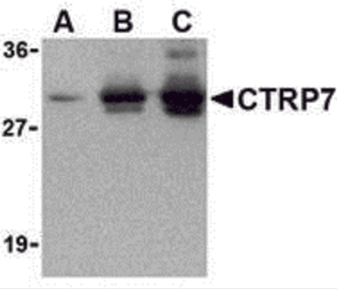 Western blot of recombinant CTRP7: (A) 5 ng, (B) 25 ng, and (C) 50 ng with CTRP2 antibody at 1 μg/mL.
