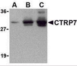 Western blot of recombinant CTRP7: (A) 5 ng, (B) 25 ng, and (C) 50 ng with CTRP2 antibody at 1 μg/mL.