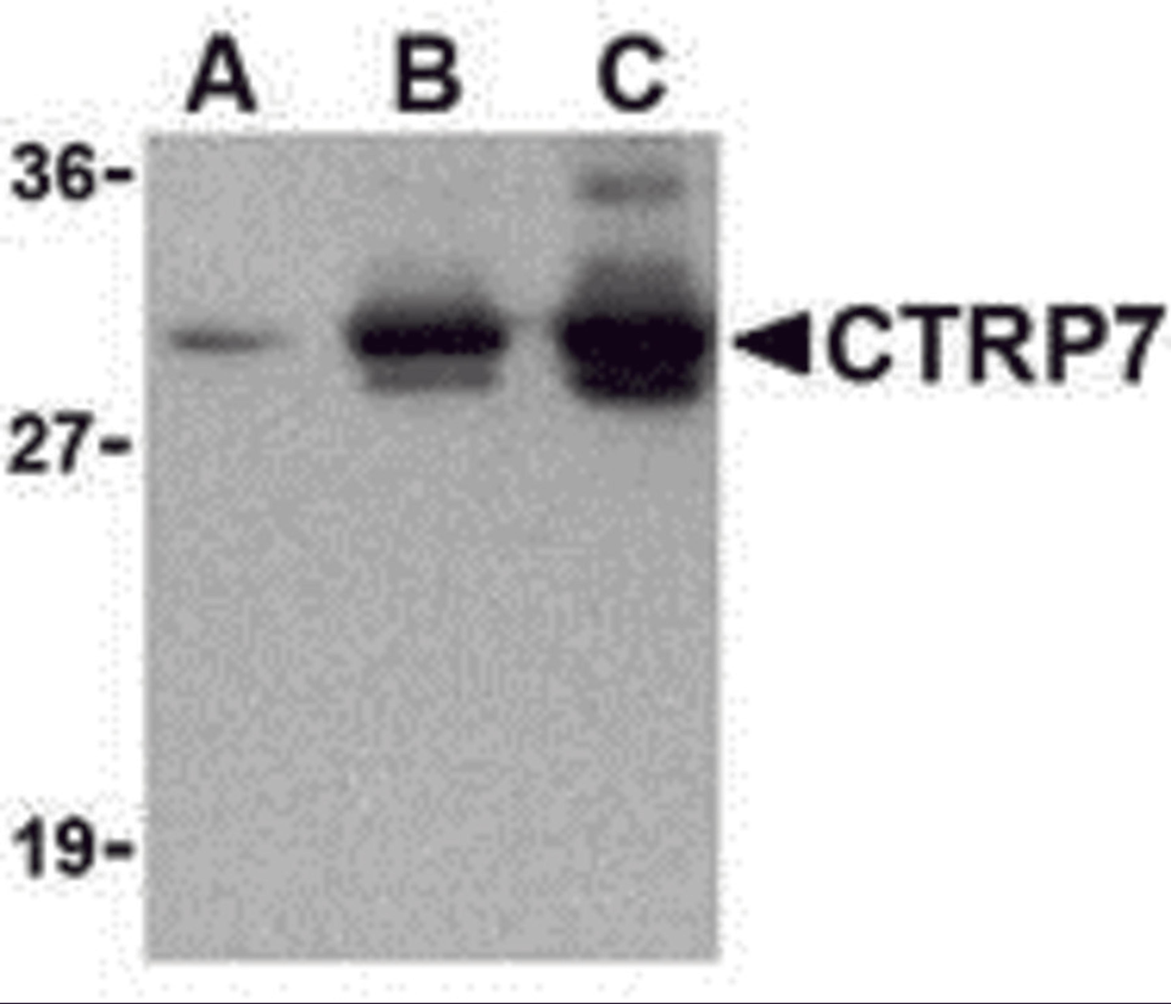 Western blot of recombinant CTRP7: (A) 5 ng, (B) 25 ng, and (C) 50 ng with CTRP2 antibody at 1 μg/mL.