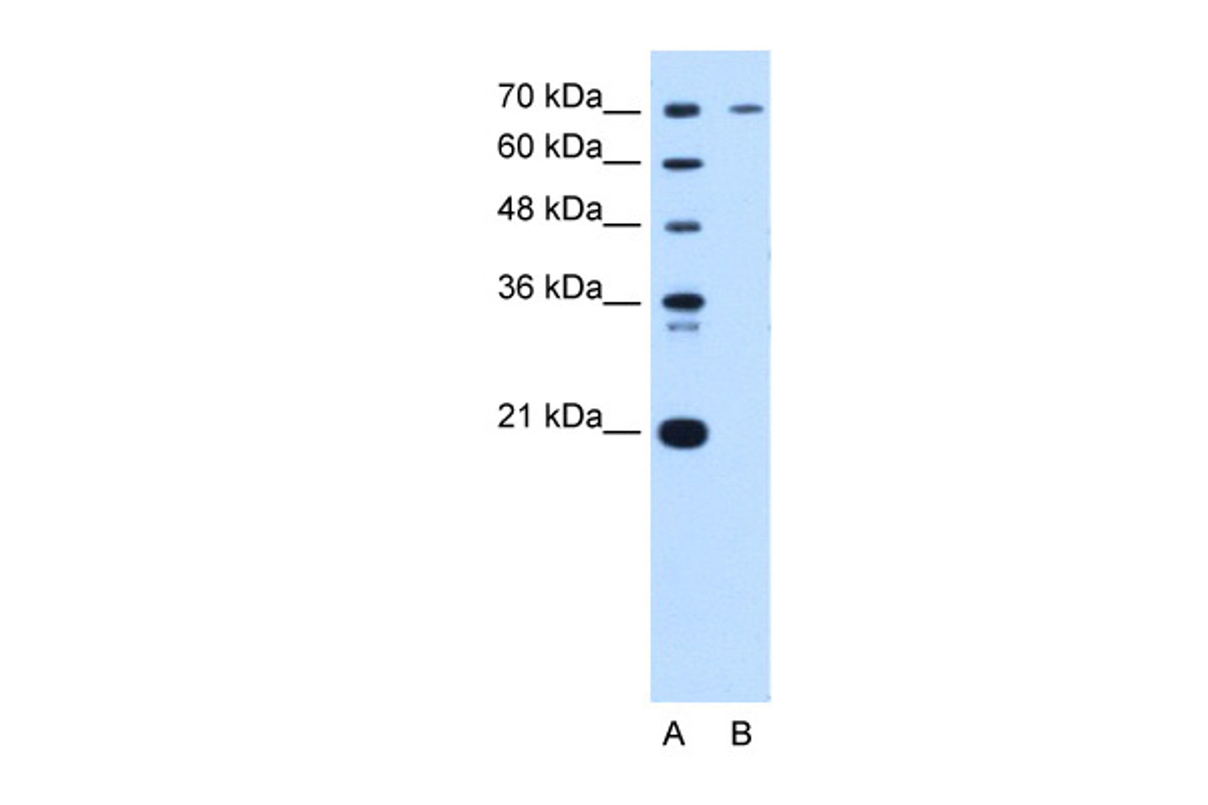 Antibody used in WB on Human HepG2 at 0.2-1 ug/ml.