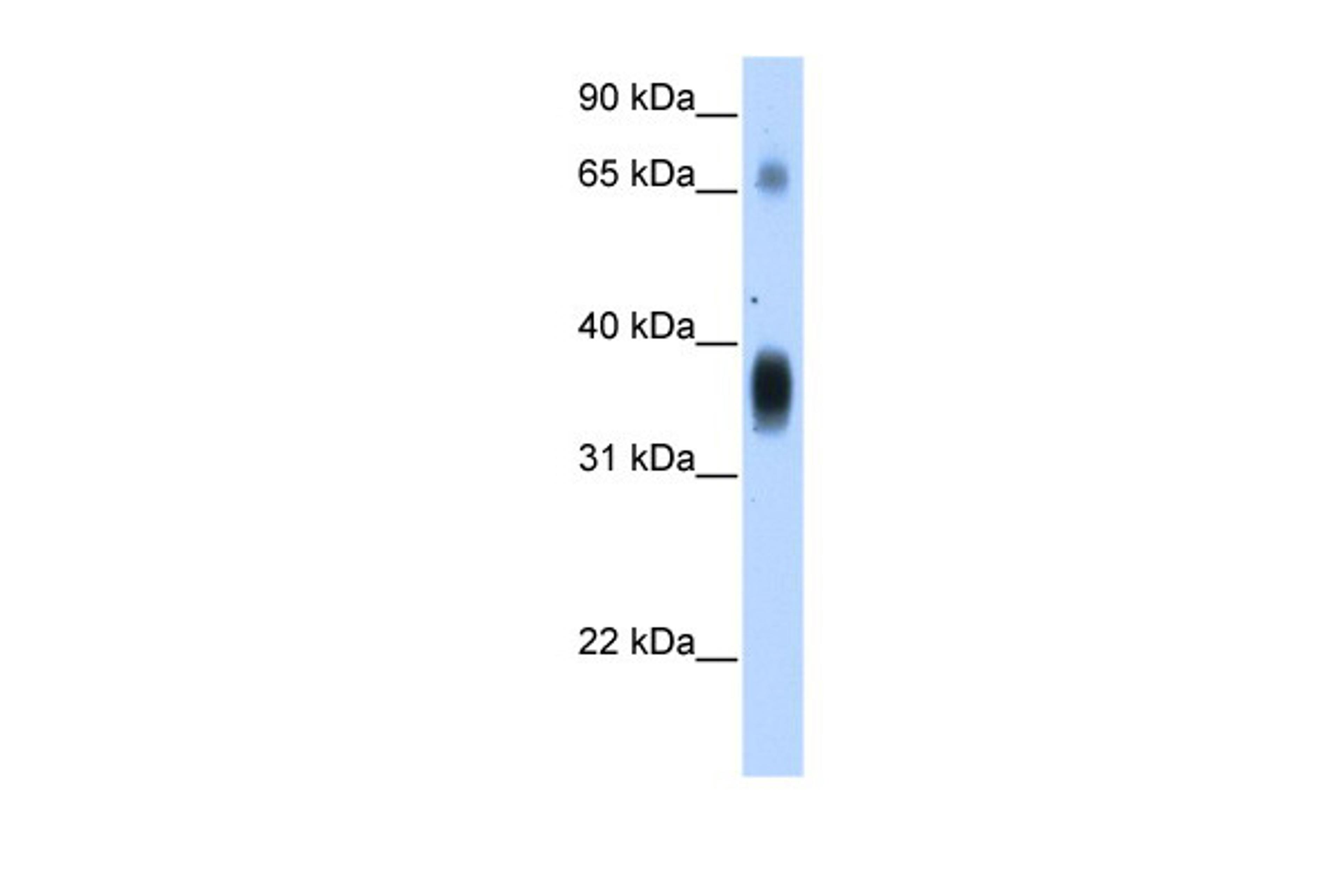 Antibody used in WB on Transfected 293T at 1.25 ug/ml.