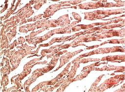 Immunohistochemical analysis of paraffin-embedded Rat Heart Tissue using VE-Cadherin  Mouse mAb diluted at 1:200.