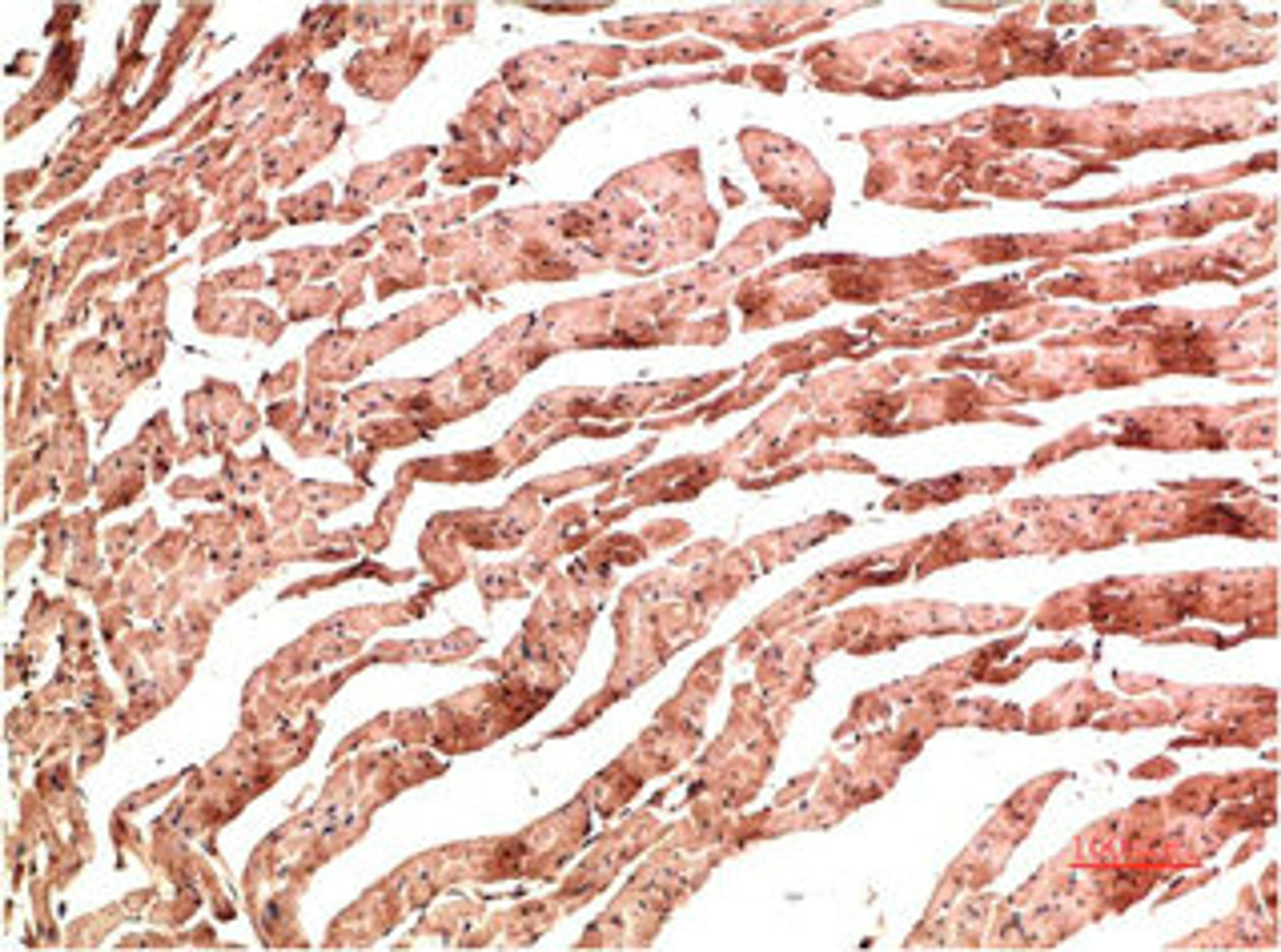 Immunohistochemical analysis of paraffin-embedded Rat Heart Tissue using VE-Cadherin  Mouse mAb diluted at 1:200.
