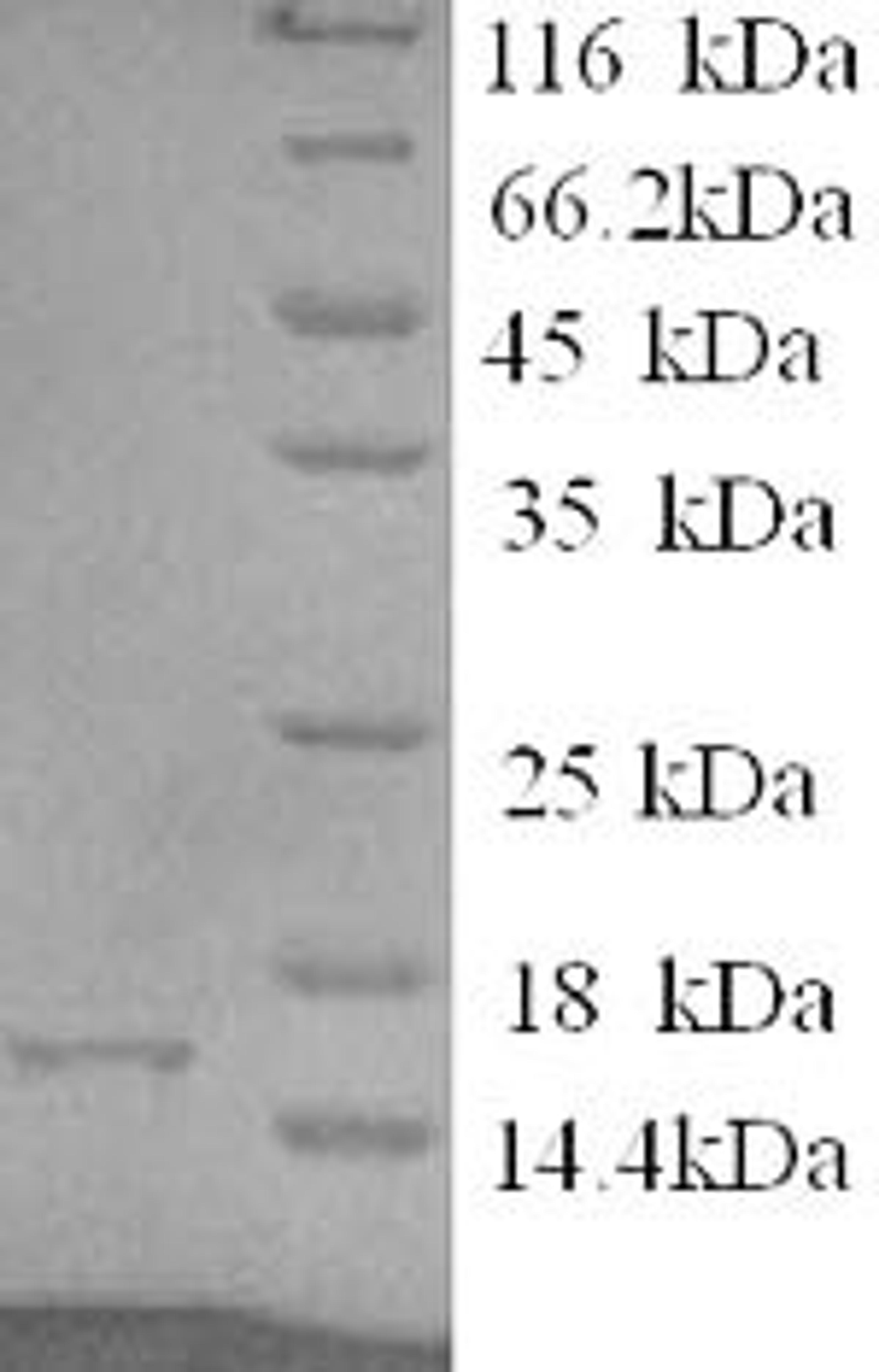 (Tris-Glycine gel) Discontinuous SDS-PAGE (reduced) with 5% enrichment gel and 15% separation gel.