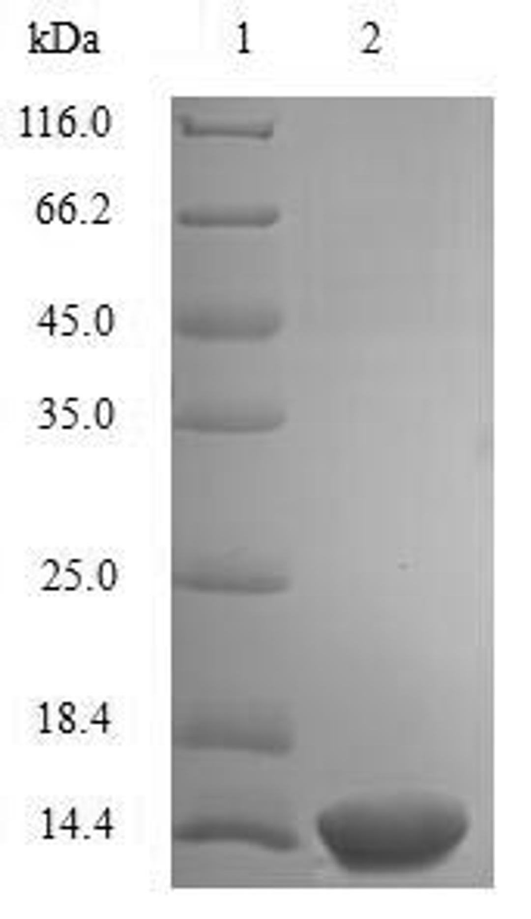 (Tris-Glycine gel) Discontinuous SDS-PAGE (reduced) with 5% enrichment gel and 15% separation gel.