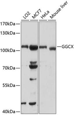 Western blot - GGCX antibody (A1806)