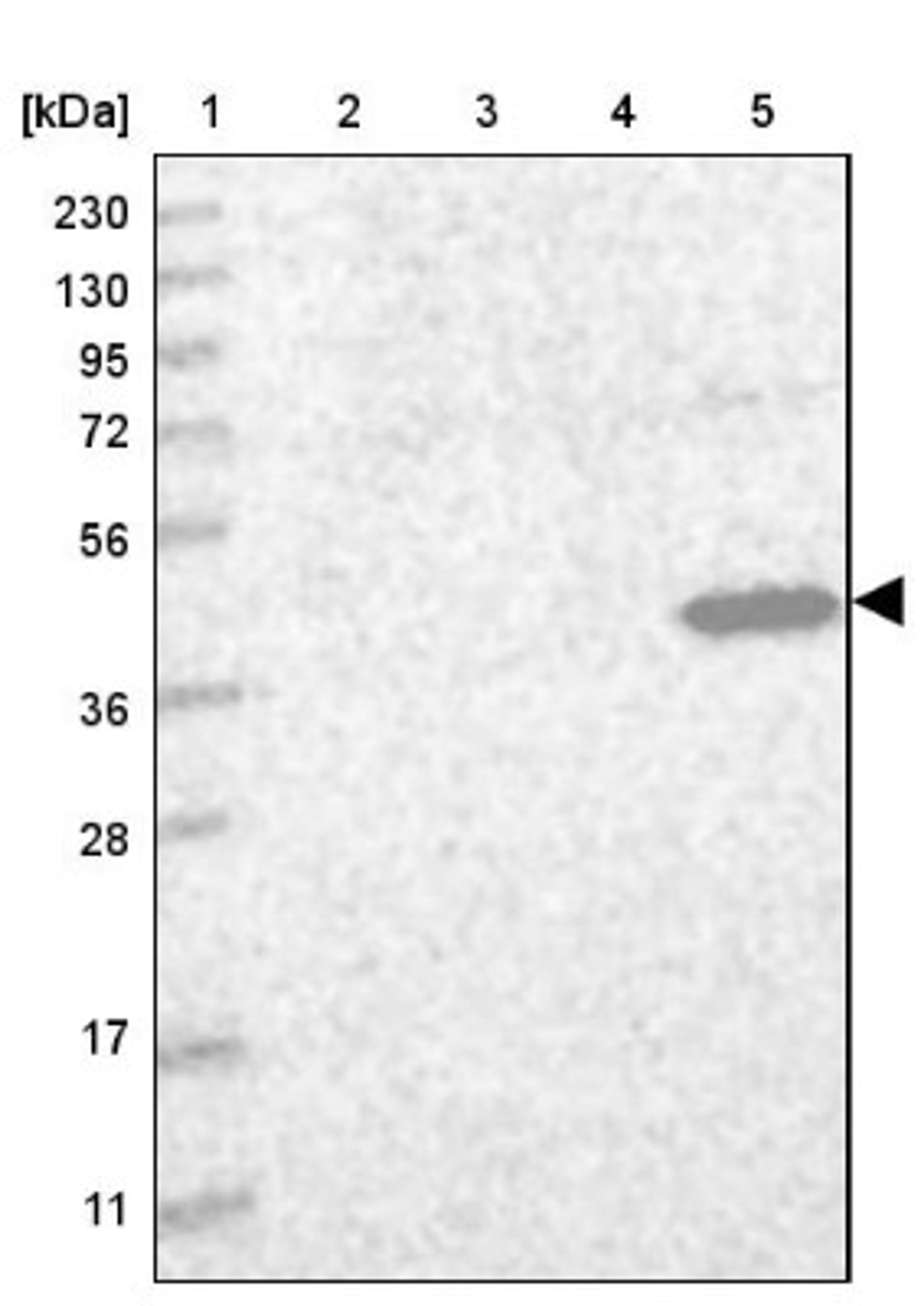 Western Blot: C3orf33 Antibody [NBP1-90874] - Lane 1: Marker [kDa] 230, 130, 95, 72, 56, 36, 28, 17, 11<br/>Lane 2: Human cell line RT-4<br/>Lane 3: Human cell line U-251MG sp<br/>Lane 4: Human plasma (IgG/HSA depleted)<br/>Lane 5: Human liver tissue