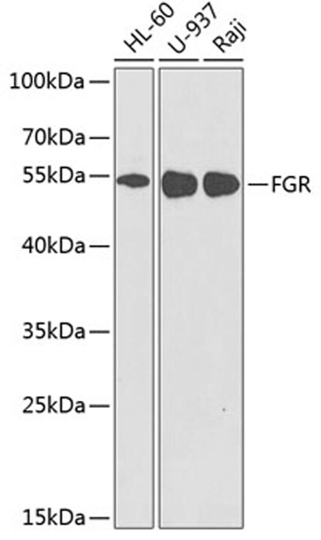 Western blot - FGR antibody (A2075)