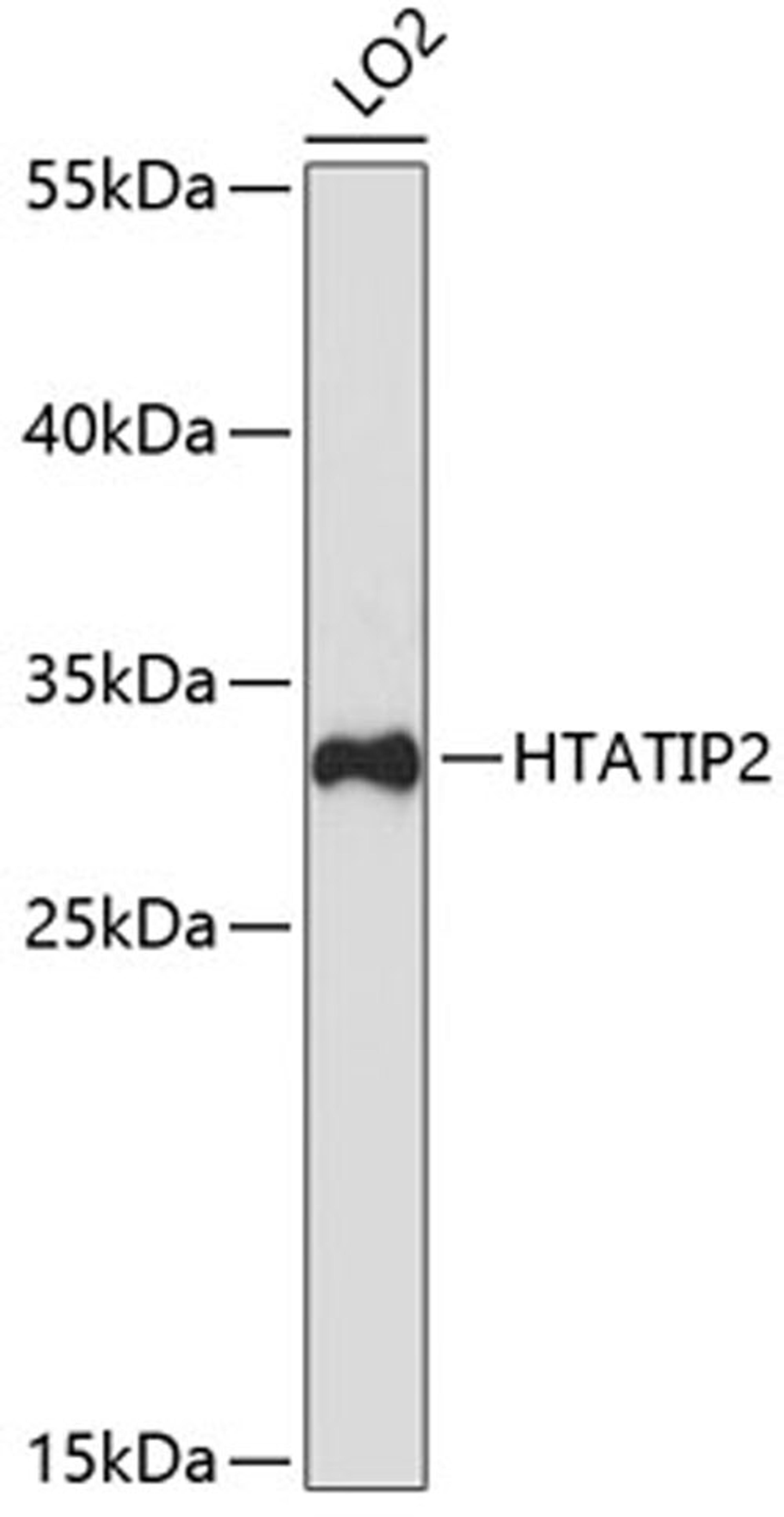 Western blot - HTATIP2 antibody (A5816)