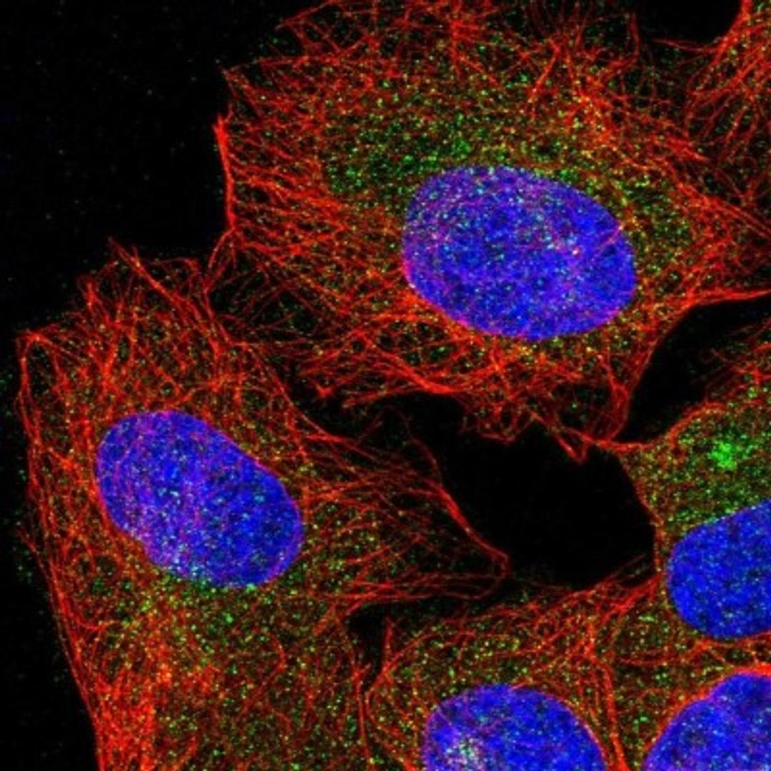 Immunocytochemistry/Immunofluorescence: Morg1 Antibody [NBP1-92133] - Staining of human cell line U-2 OS shows positivity in vesicles.