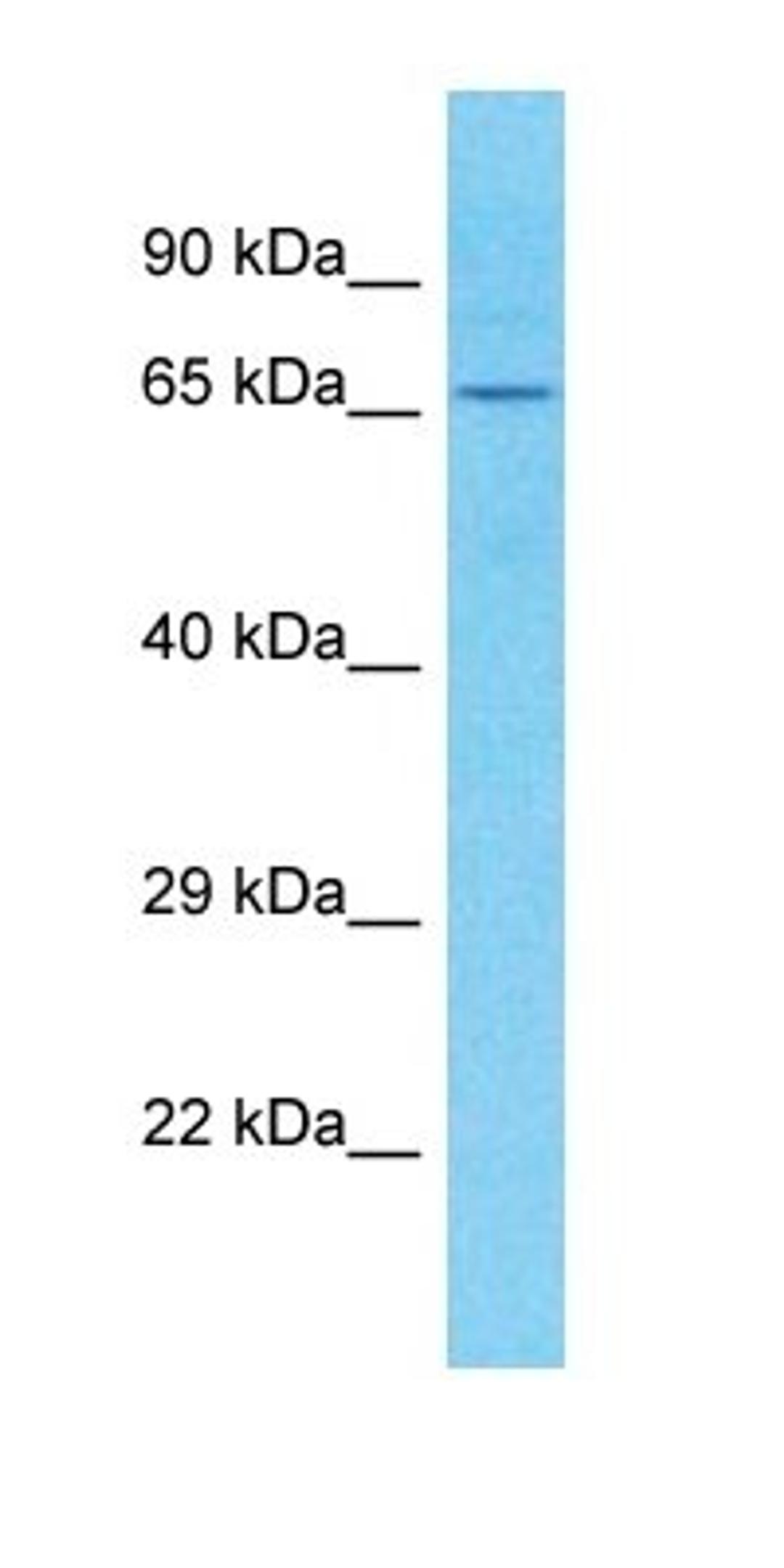 Western blot analysis of human Placenta tissue using C1orf113 antibody