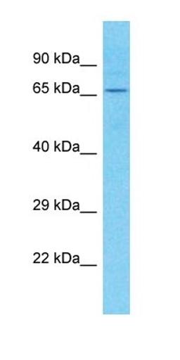 Western blot analysis of human Placenta tissue using C1orf113 antibody