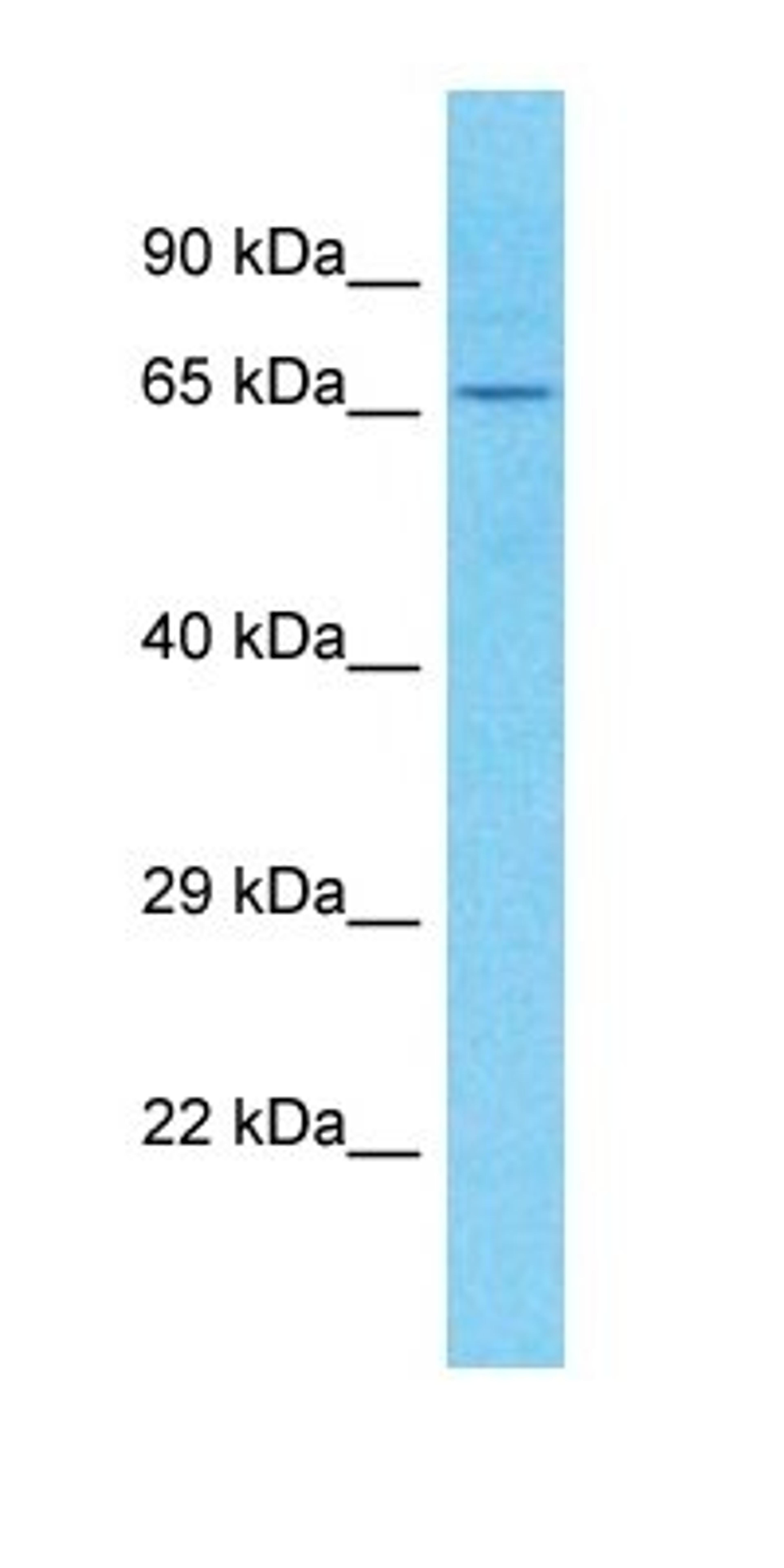 Western blot analysis of human Placenta tissue using C1orf113 antibody