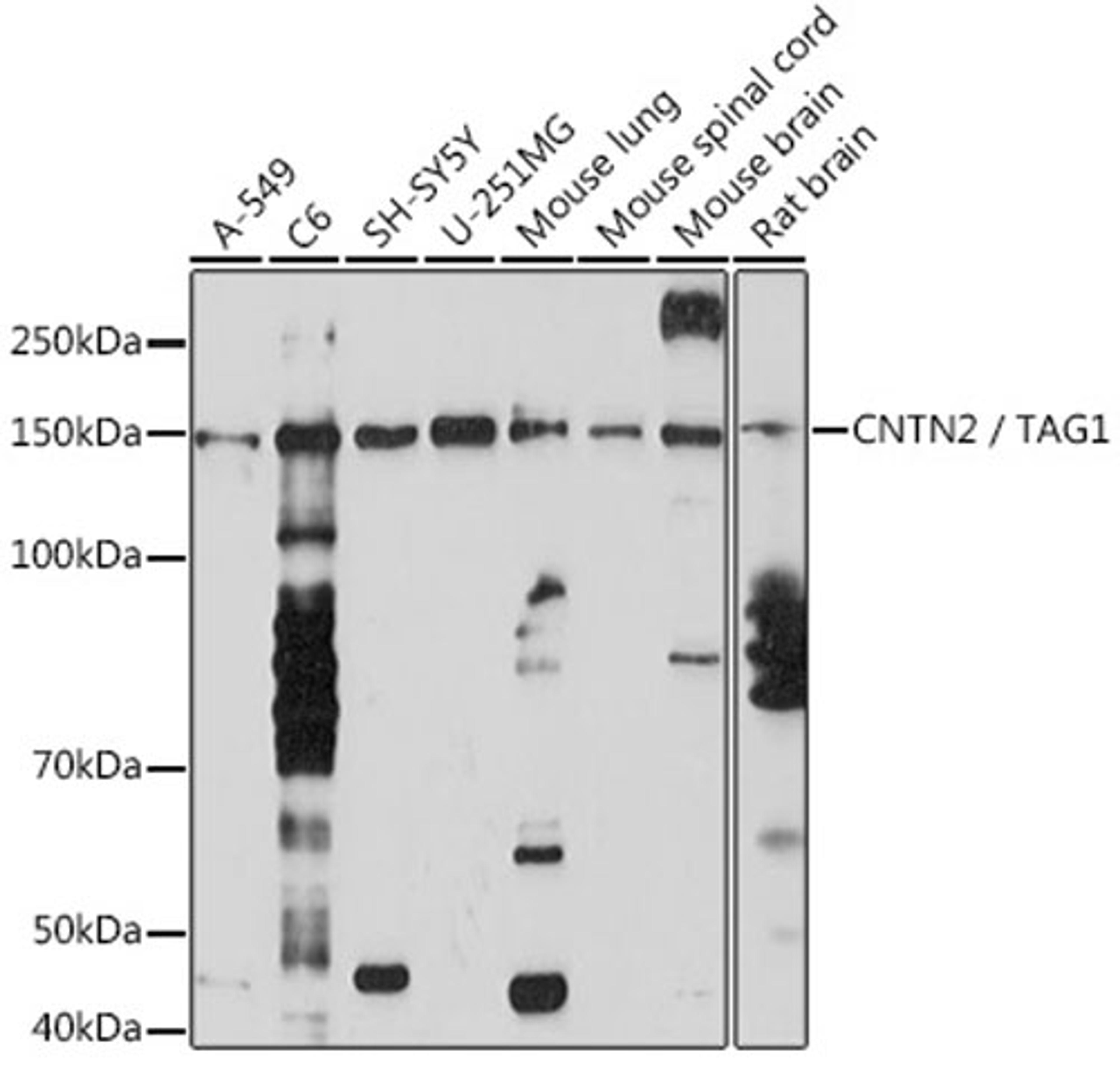 Western blot - CNTN2 / TAG1 Rabbit mAb (A5137)