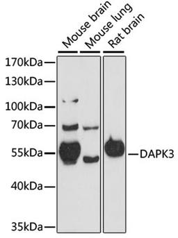 Western blot - DAPK3 antibody (A15047)