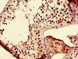Immunohistochemistry of paraffin-embedded human testis tissue using CSB-PA741049LA01HU at dilution of 1:100