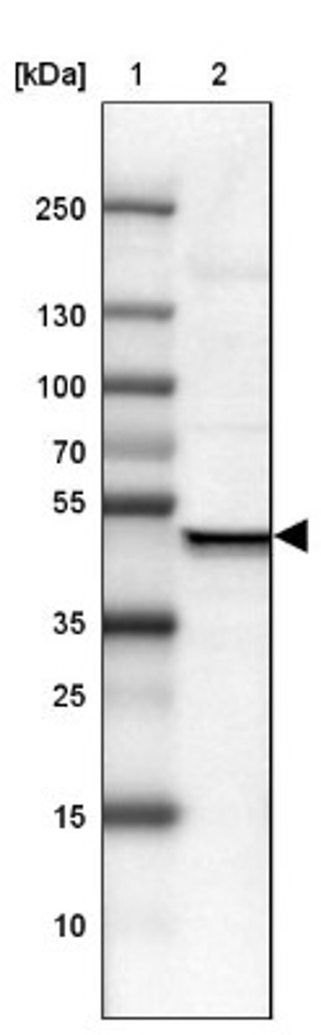 Western Blot: USP16 Antibody [NBP1-86881] - Lane 1: Marker [kDa] 250, 130, 100, 70, 55, 35, 25, 15, 10<br/>Lane 2: Liver