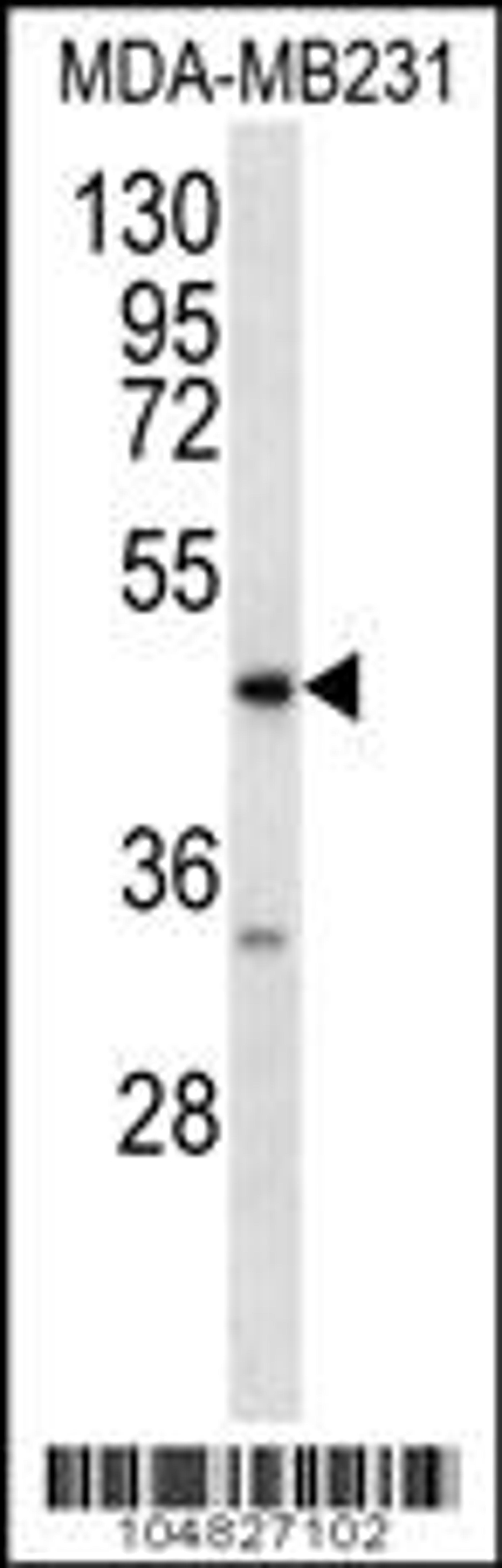 Western blot analysis in MDA-MB231 cell line lysates (35ug/lane).