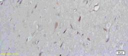 Immunohistochemical analysis of paraffin-embedded rat brain tissue using beta 3 Adrenergic Receptor antibody.