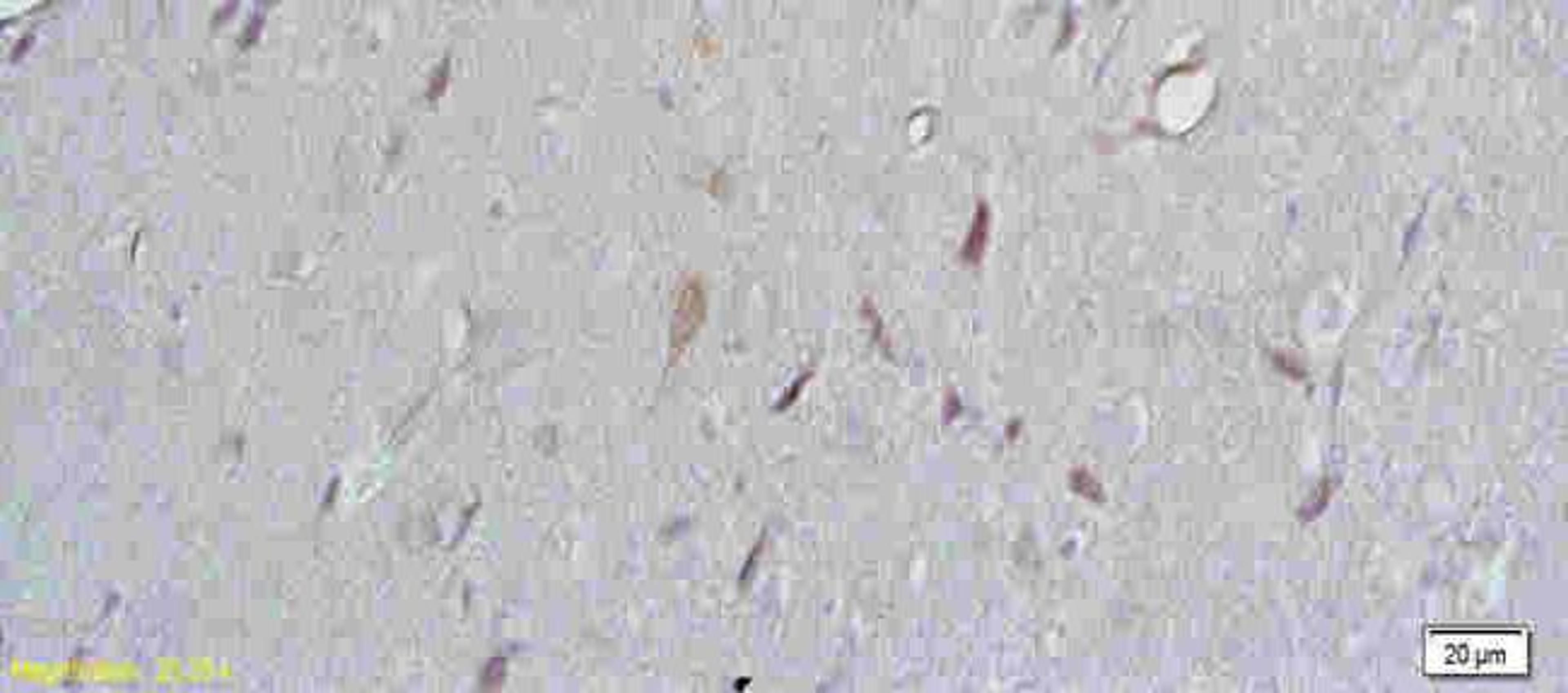 Immunohistochemical analysis of paraffin-embedded rat brain tissue using beta 3 Adrenergic Receptor antibody.