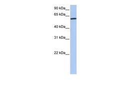 Antibody used in WB on Human Brain at 0.2-1 ug/ml.