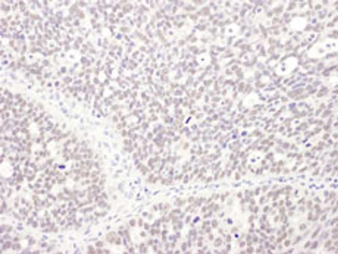 Detection of human MEPCE by immunohistochemistry.