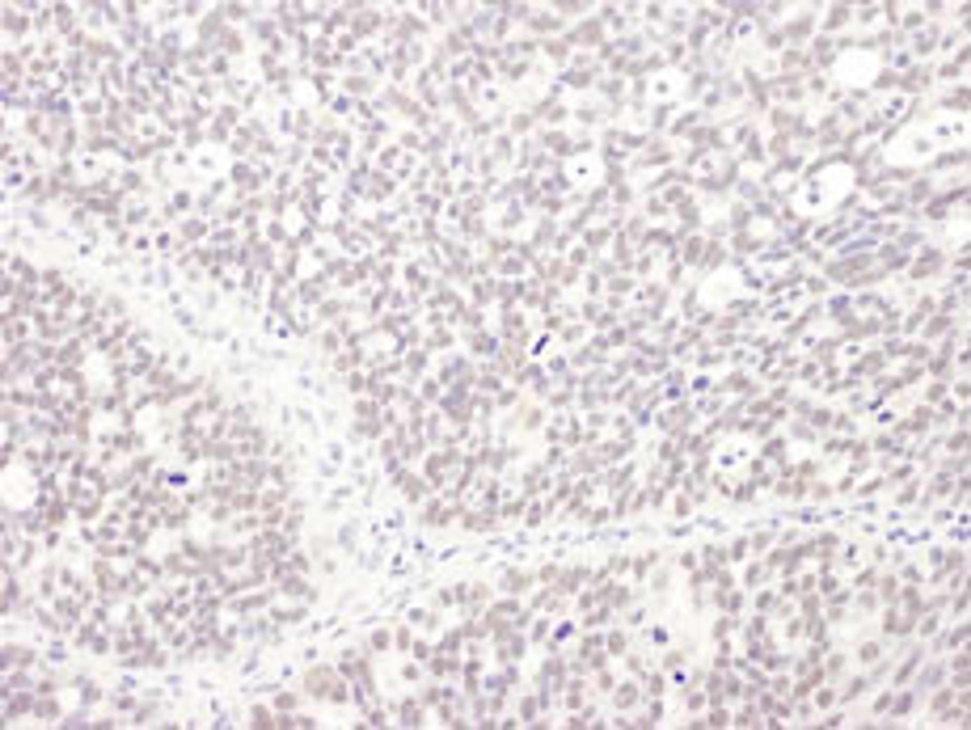 Detection of human MEPCE by immunohistochemistry.