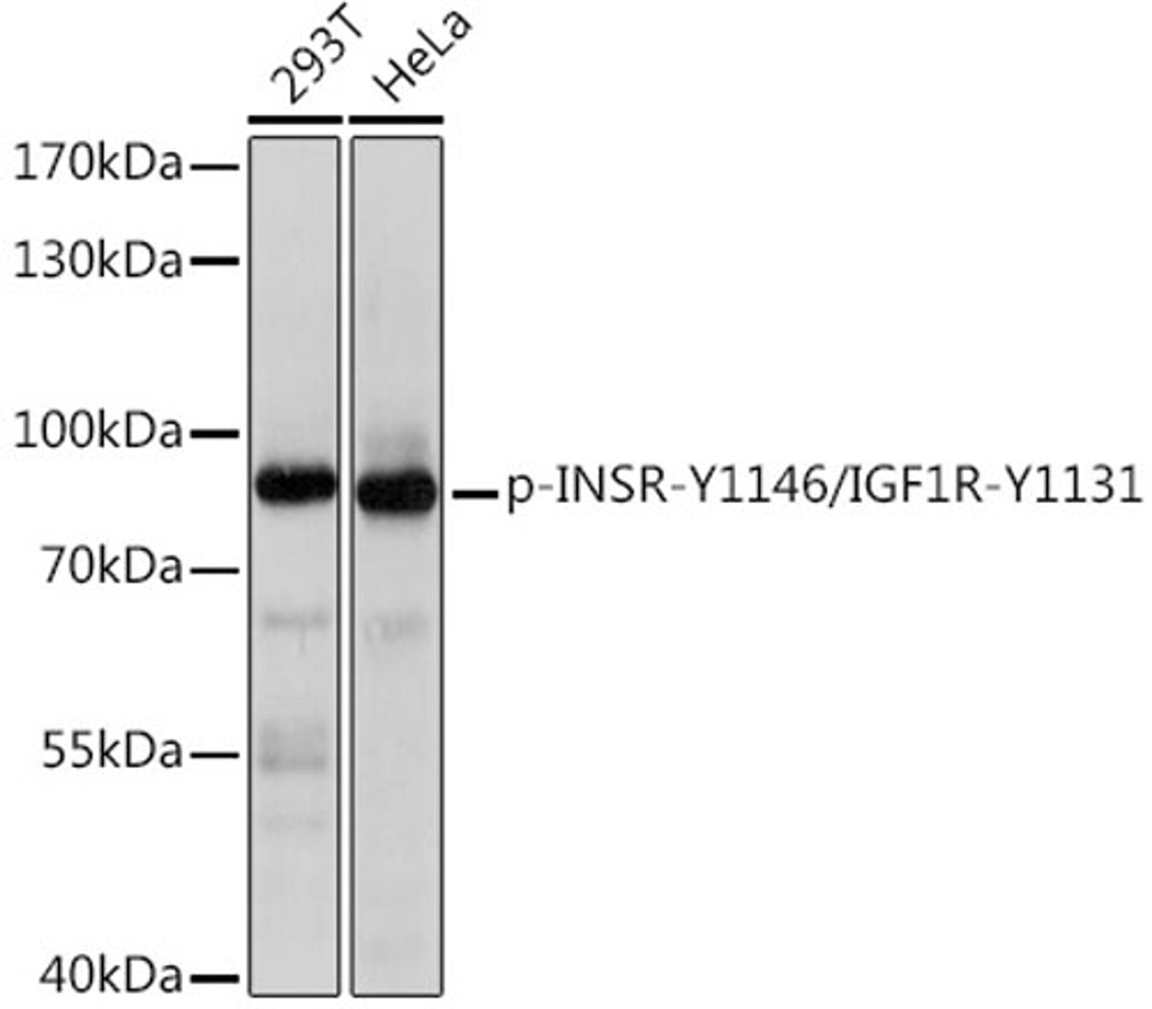 Western blot - Phospho-INSR-Y1146/IGF1R-Y1131 Rabbit pAb (AP0863)