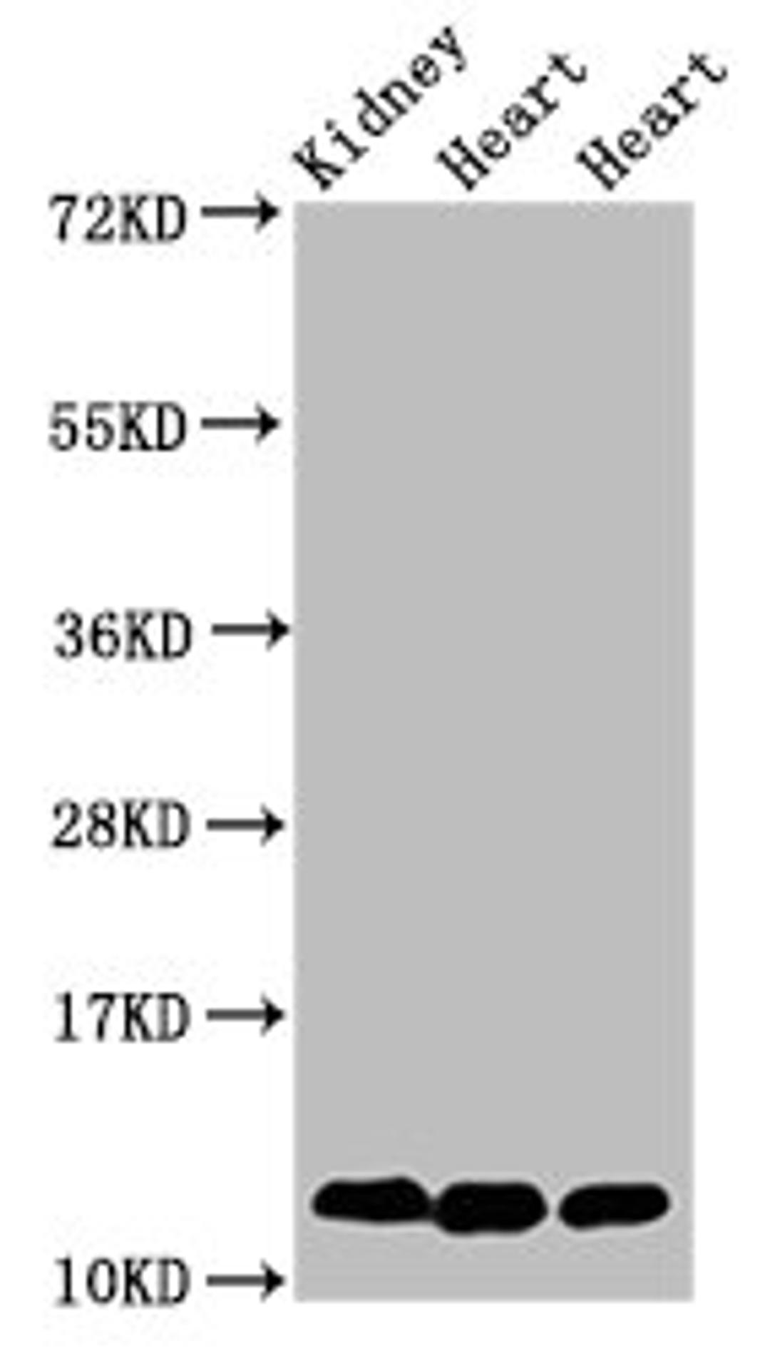 Western Blot. Positive WB detected in: Rat kidney tissue, Rat heart tissue, Mouse heart tissue. All lanes: CYCS antibody at 2µg/ml. Secondary. Goat polyclonal to rabbit IgG at 1/50000 dilution. Predicted band size: 12 kDa. Observed band size: 12 kDa