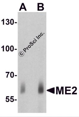 Western blot analysis of ME2 in human spleen tissue lysate with ME2 antibody at (A) 1 and (B) 2&#956;g/ml.