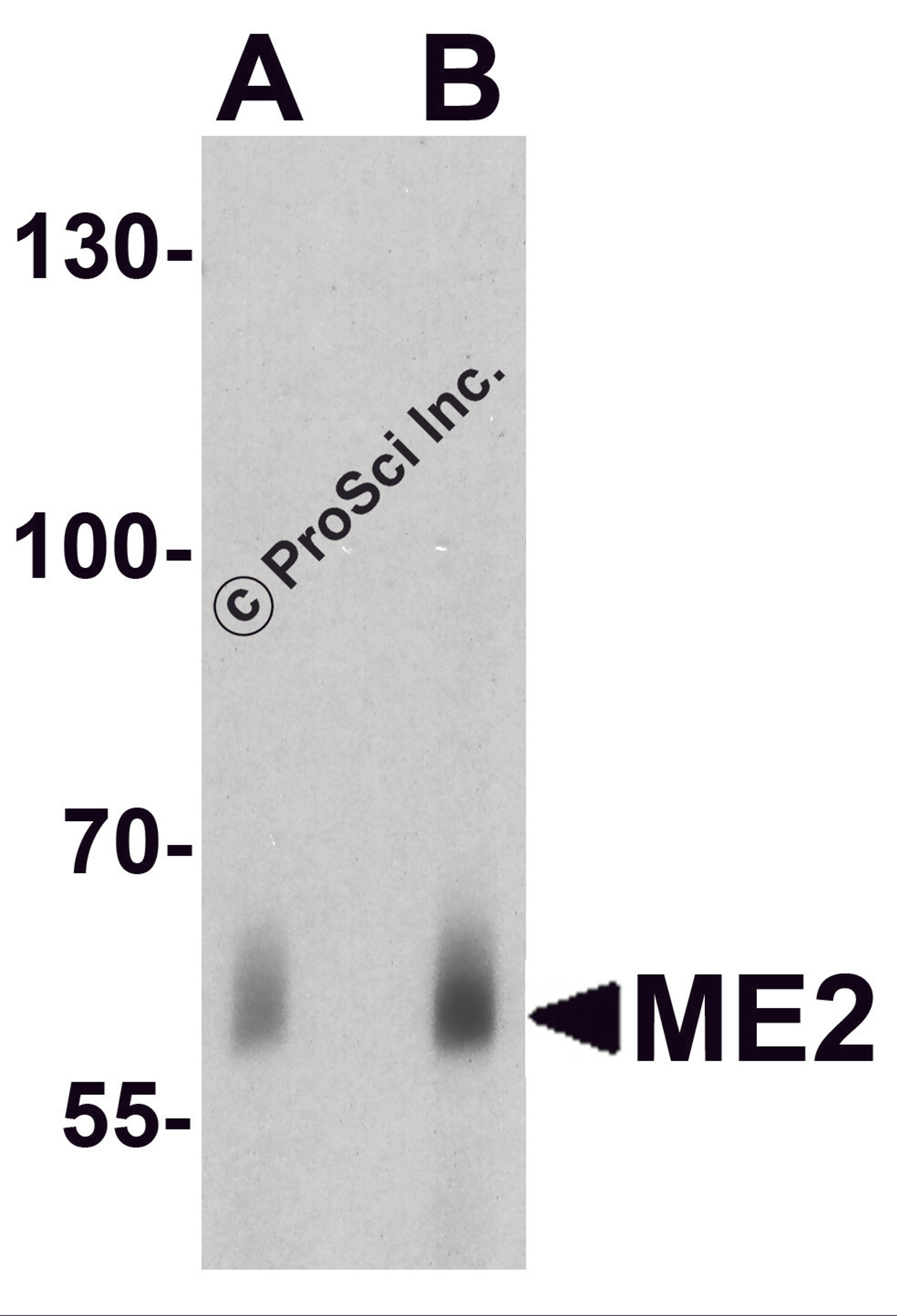 Western blot analysis of ME2 in human spleen tissue lysate with ME2 antibody at (A) 1 and (B) 2&#956;g/ml.