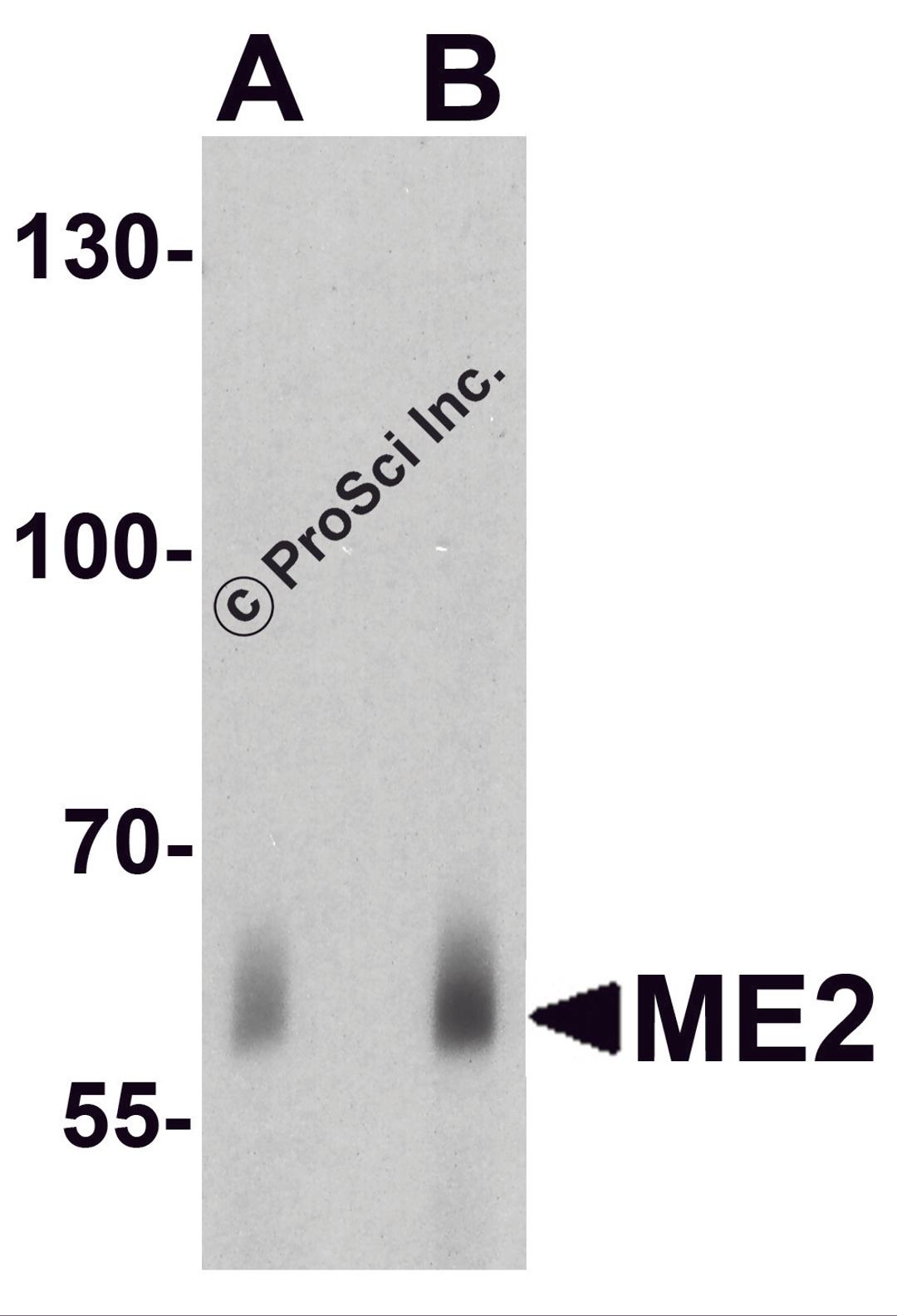 Western blot analysis of ME2 in human spleen tissue lysate with ME2 antibody at (A) 1 and (B) 2μg/ml.