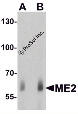 Western blot analysis of ME2 in human spleen tissue lysate with ME2 antibody at (A) 1 and (B) 2μg/ml.
