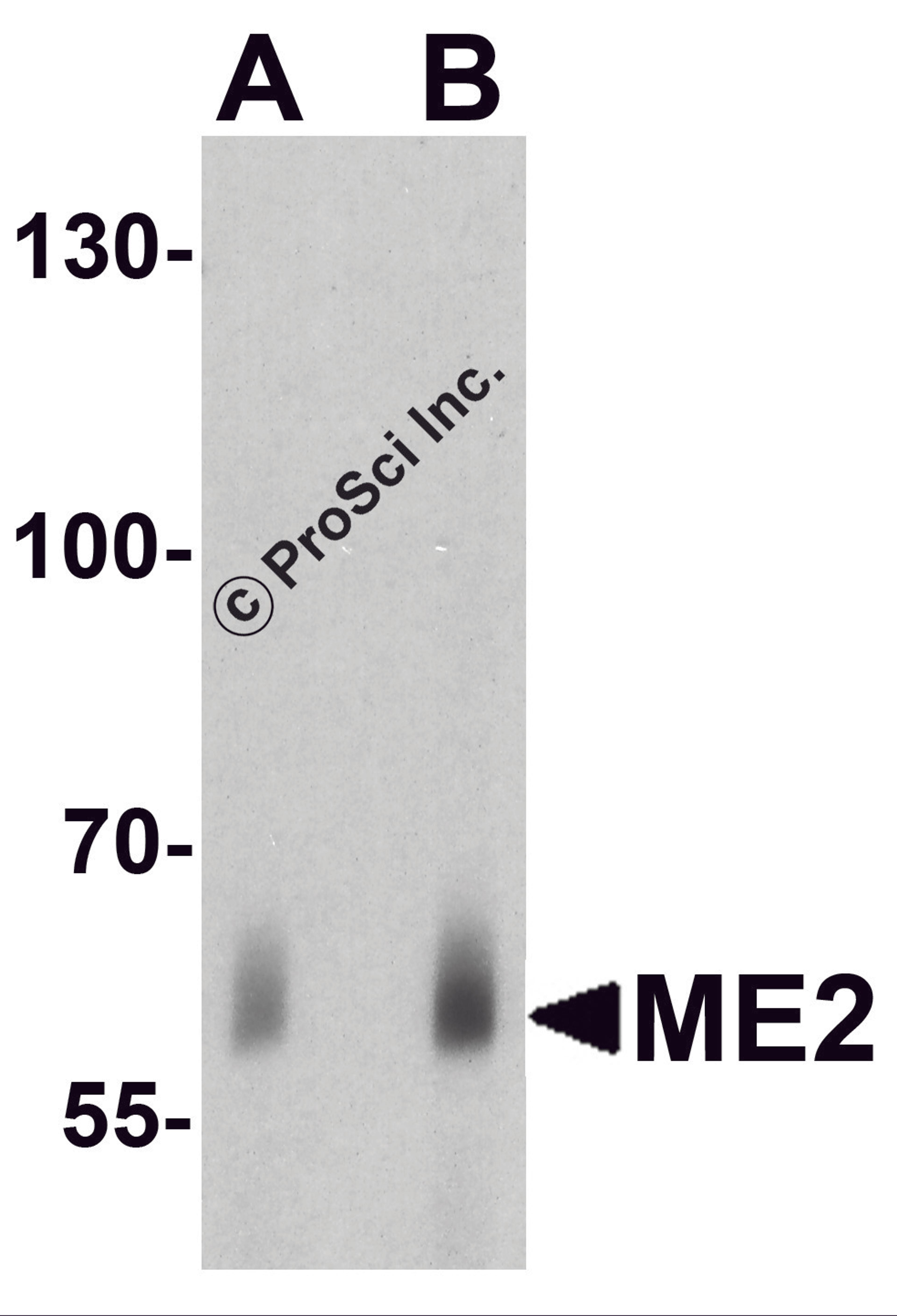 Western blot analysis of ME2 in human spleen tissue lysate with ME2 antibody at (A) 1 and (B) 2μg/ml.