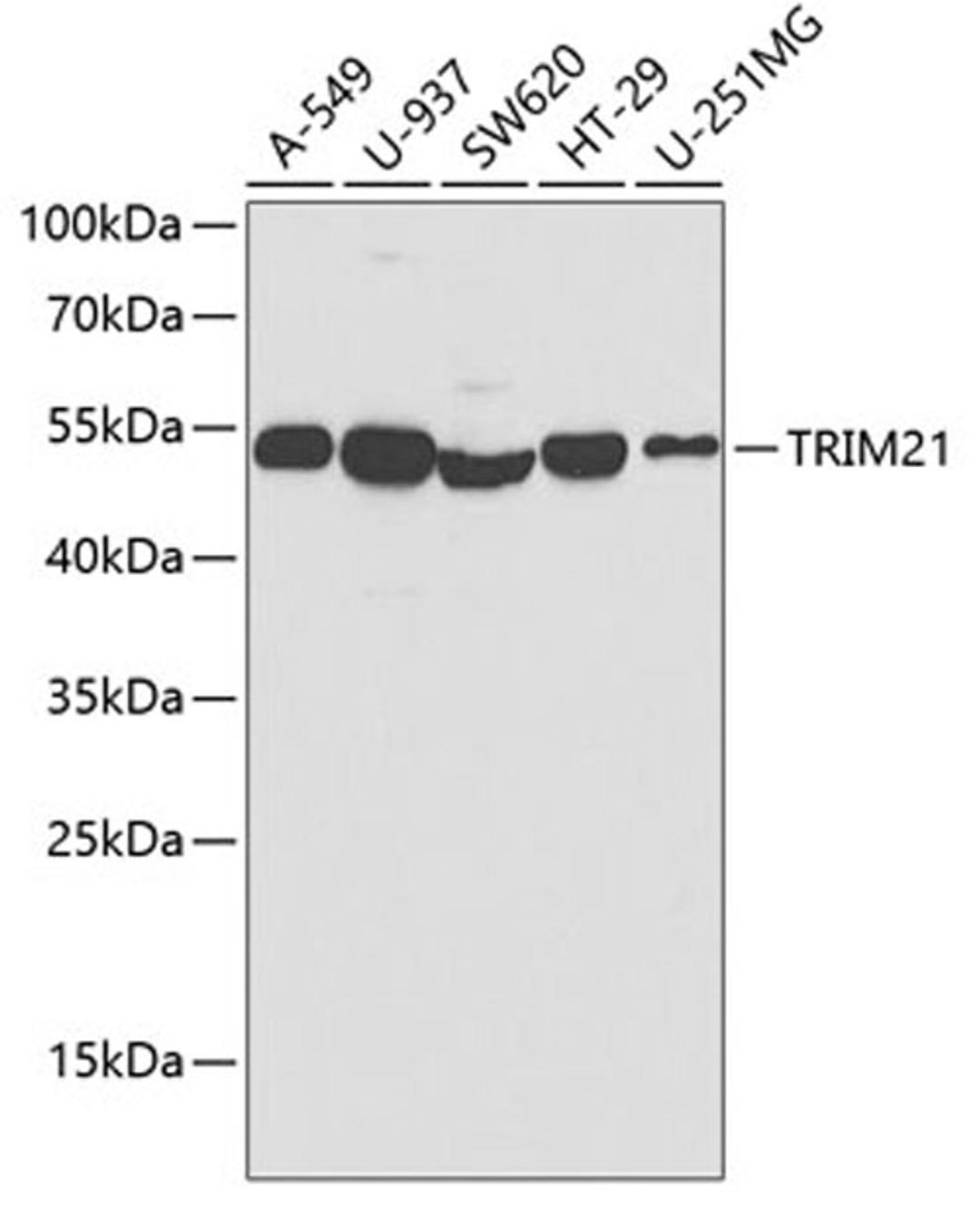 Western blot - TRIM21 antibody (A1957)