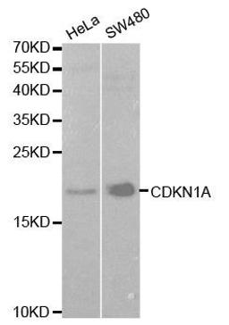 Western blot analysis of extracts of various cell lines using CDKN1A antibody