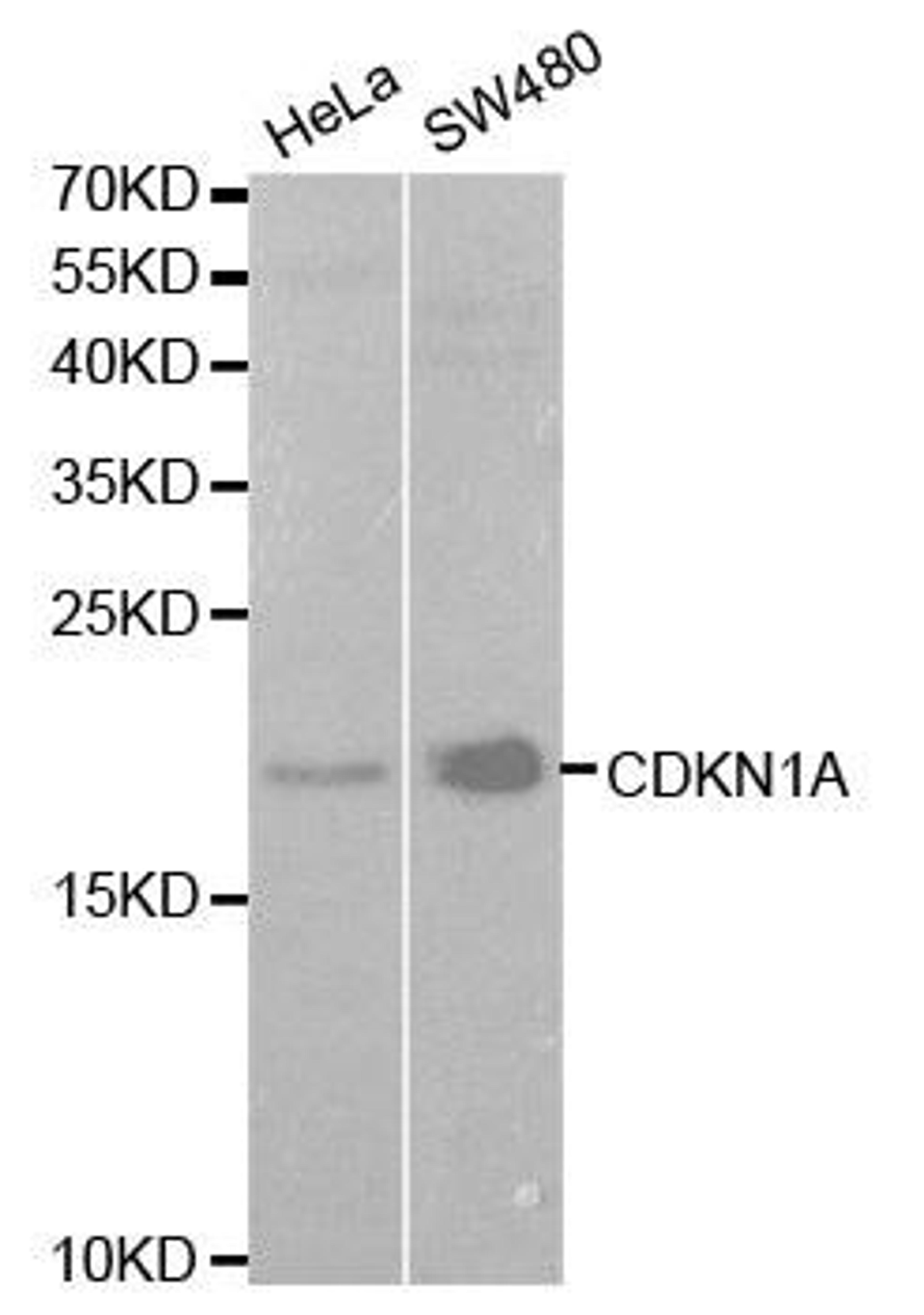 Western blot analysis of extracts of various cell lines using CDKN1A antibody